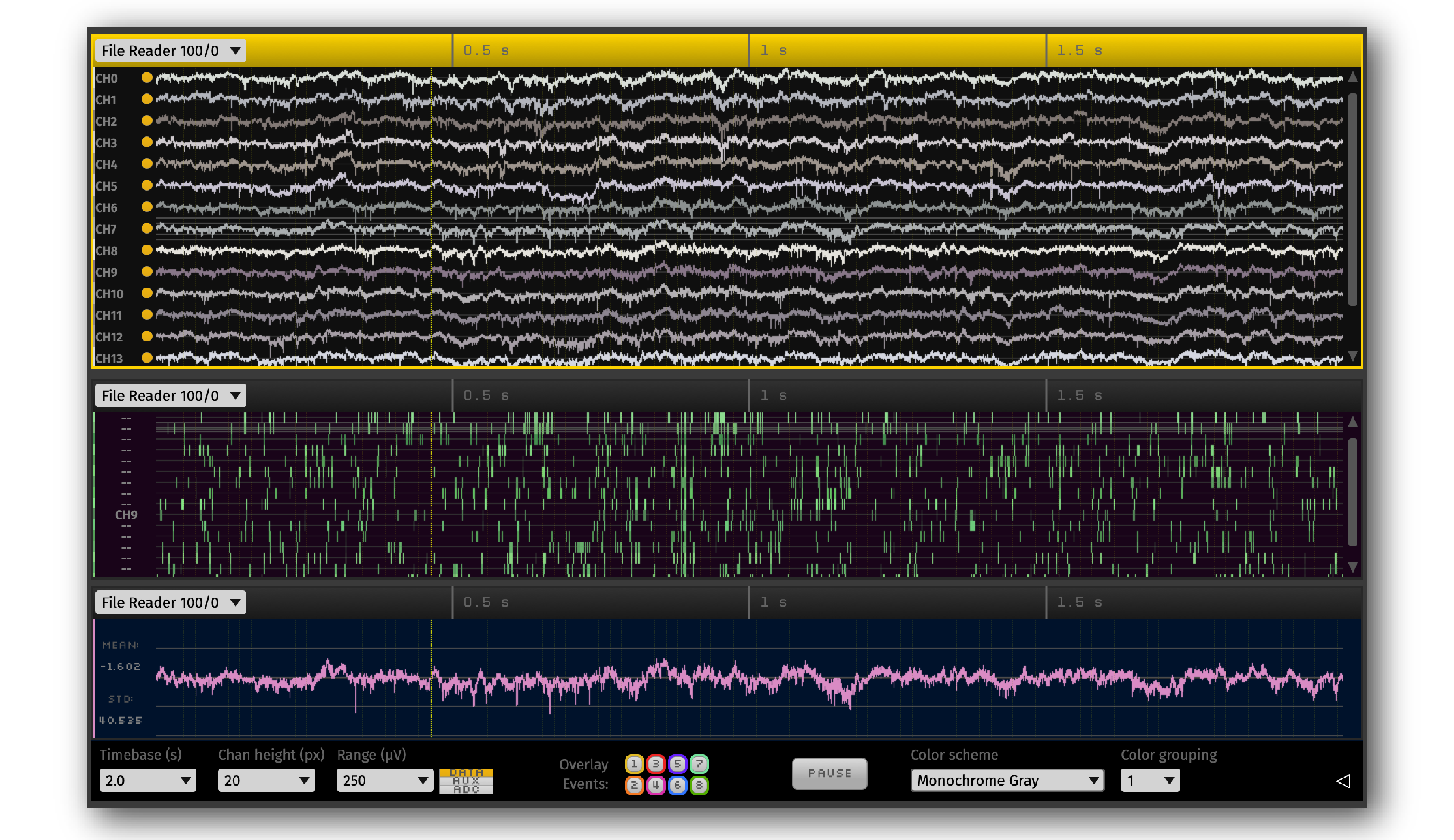 Open Ephys @openephys@mastodon.online (@OpenEphys) / X