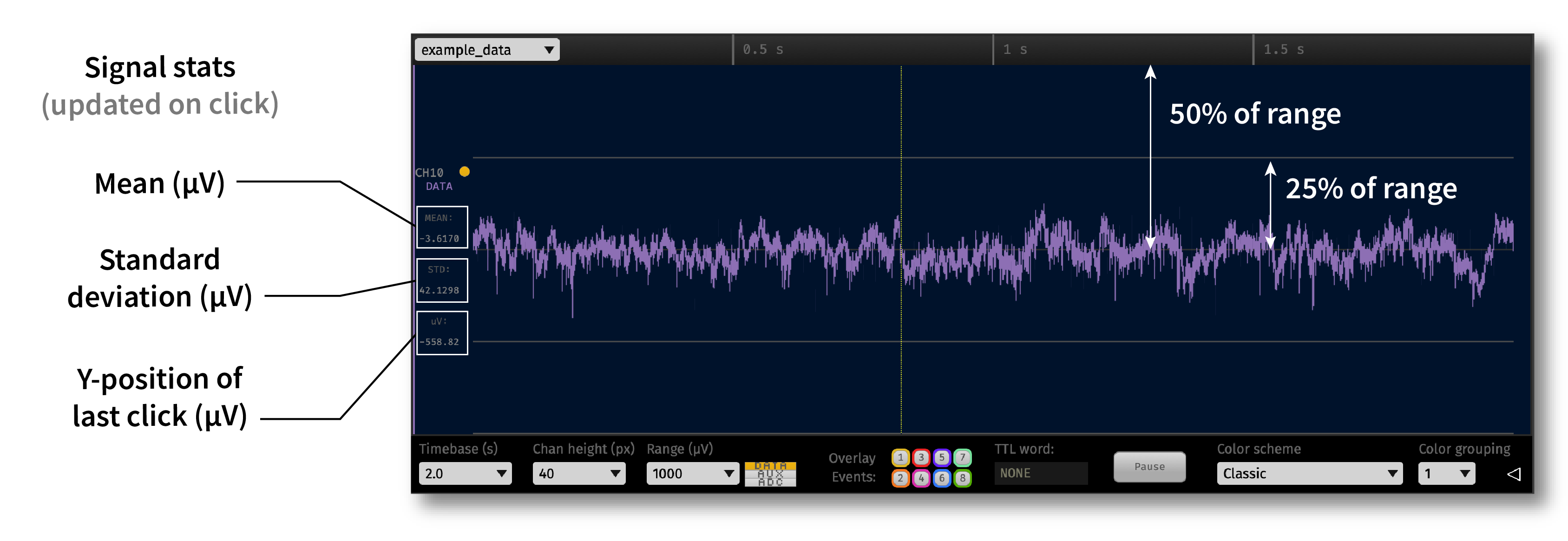 Annotated single-channel view