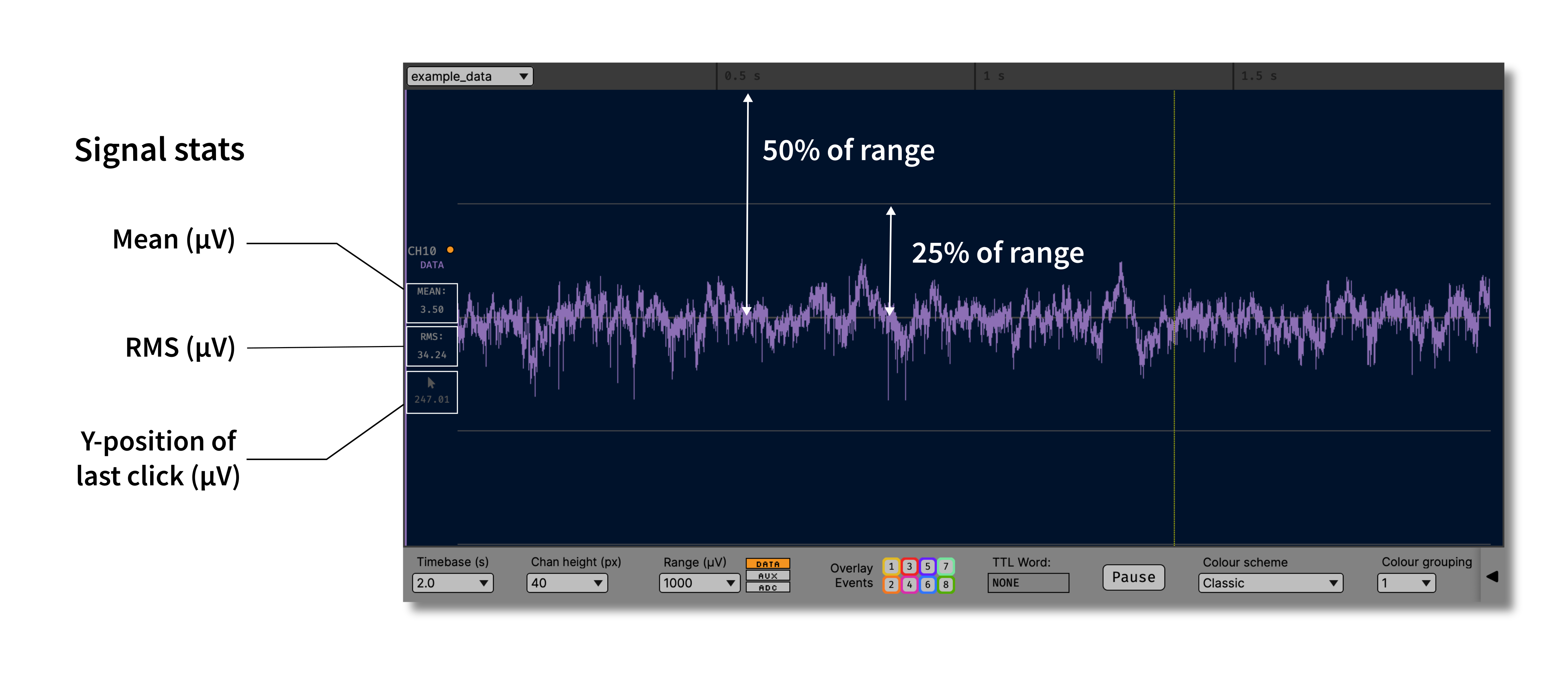 Annotated single-channel view